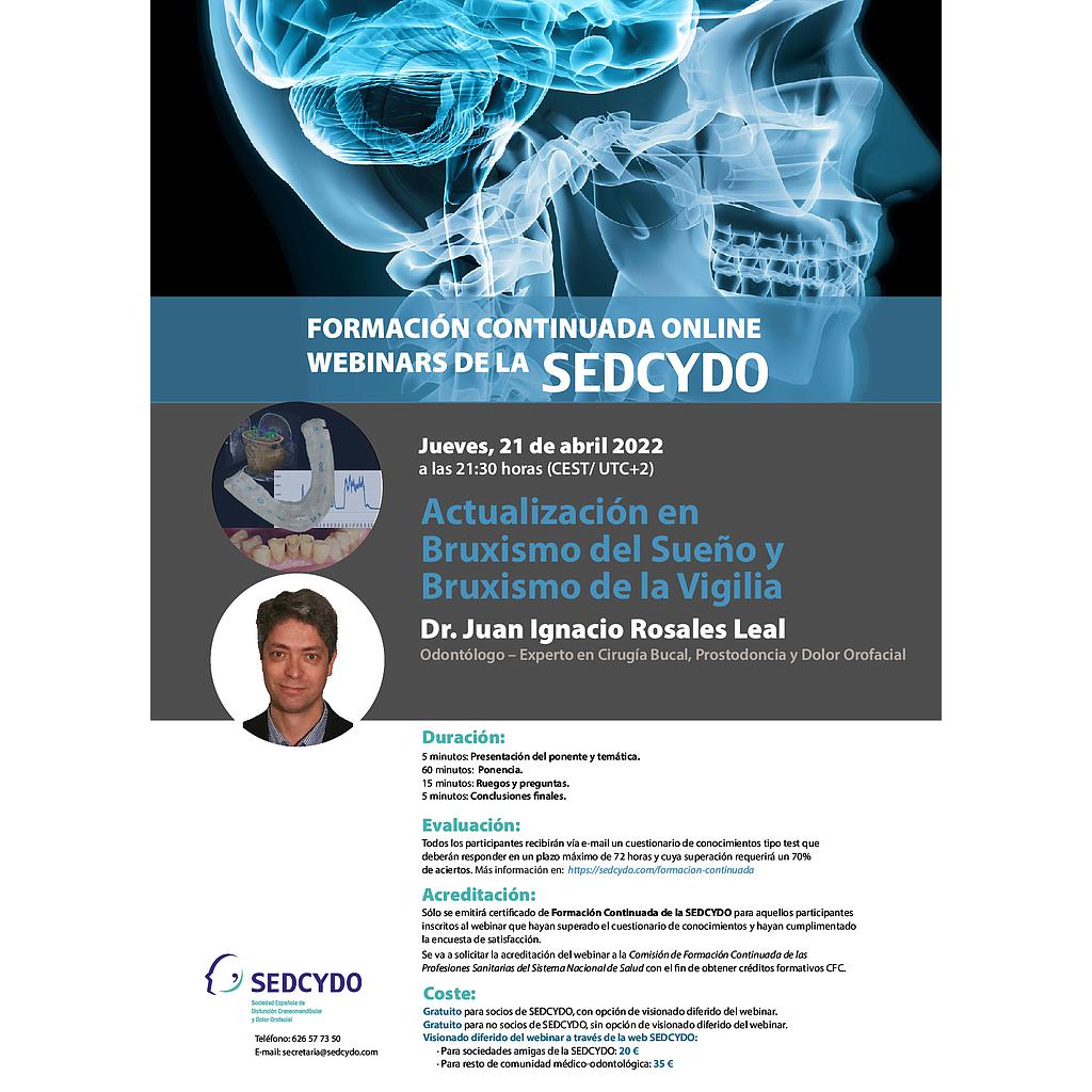 Actualización en Bruxismo del Sueño y Bruxismo de la Vigilia